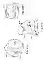 Fig. 147 - Patient-adapted and improved articular implants, designs and related guide tools