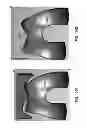 Fig. 149 - Patient-adapted and improved articular implants, designs and related guide tools