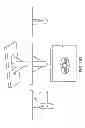 Fig. 201 - Patient-adapted and improved articular implants, designs and related guide tools