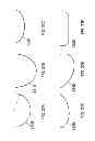 Fig. 43 - Patient-adapted and improved articular implants, designs and related guide tools