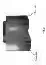 Fig. 46 - Patient-adapted and improved articular implants, designs and related guide tools