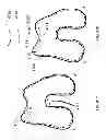 Fig. 52 - Patient-adapted and improved articular implants, designs and related guide tools