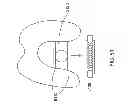 Fig. 69 - Patient-adapted and improved articular implants, designs and related guide tools