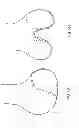 Fig. 74 - Patient-adapted and improved articular implants, designs and related guide tools
