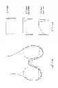 Fig. 75 - Patient-adapted and improved articular implants, designs and related guide tools
