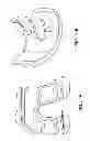 Fig. 79 - Patient-adapted and improved articular implants, designs and related guide tools