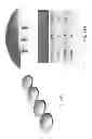 Fig. 86 - Patient-adapted and improved articular implants, designs and related guide tools