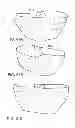 Fig. 90 - Patient-adapted and improved articular implants, designs and related guide tools