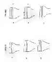 Fig. 97 - Patient-adapted and improved articular implants, designs and related guide tools