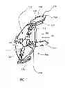 Fig. 02 - GLENOID VAULT FIXATION SYSTEM