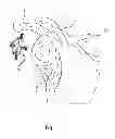 Fig. 03 - GLENOID VAULT FIXATION SYSTEM