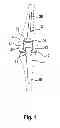 Fig. 02 - Joint prosthesis having a bending hinge that comprises a spreading axle