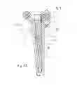 Fig. 09 - Sleeve for modular revision hip stem