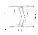 Fig. 04 - Implantable device for directional control of flow within the anatomic tracts of the body