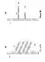 Fig. 08 - Implantable device for directional control of flow within the anatomic tracts of the body
