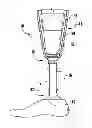 Fig. 01 - Systems and methods for prosthetic suspension system
