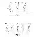 Fig. 06 - Prosthetic ankle joint mechanism