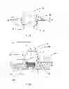 Fig. 02 - Healing abutment and method for producing a design of a healing abutment