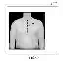 Fig. 06 - GRAPHICAL TOOL FOR MANAGING A LONGITUDINAL PATIENT EPISODE