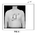 Fig. 07 - GRAPHICAL TOOL FOR MANAGING A LONGITUDINAL PATIENT EPISODE
