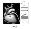 Fig. 08 - GRAPHICAL TOOL FOR MANAGING A LONGITUDINAL PATIENT EPISODE