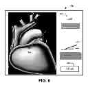 Fig. 09 - GRAPHICAL TOOL FOR MANAGING A LONGITUDINAL PATIENT EPISODE