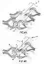Fig. 05 - Rodent model of central neuropathic pain caused by dorsal root entry zone avulsion at T13