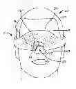 Fig. 01 - Eye mask