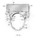 Fig. 06 - Eye mask