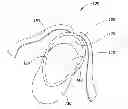 Fig. 01 - SOCK WITH ANKLE STRAPS