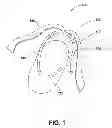 Fig. 02 - SOCK WITH ANKLE STRAPS