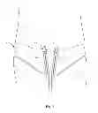 Fig. 08 - Shirt hold-down undergarment