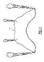 Fig. 02 - INFLATABLE SLING AND METHOD FOR POSITIONING A PATIENT