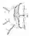 Fig. 04 - INFLATABLE SLING AND METHOD FOR POSITIONING A PATIENT