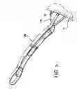 Fig. 06 - INFLATABLE SLING AND METHOD FOR POSITIONING A PATIENT