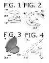 Fig. 02 - Inflatable Shaded Beach Pillow