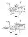 Fig. 09 - Turbine engine coupling stack