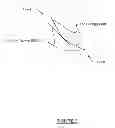 Fig. 04 - Shoe spring and shock absorbing system