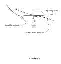 Fig. 06 - Shoe spring and shock absorbing system