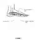 Fig. 09 - Shoe spring and shock absorbing system