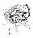 Fig. 05 - Two stage glass position for frameless vehicles