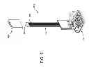 Fig. 09 - Method for setting tiles and tuning lippage