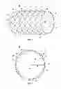 Fig. 02 - Tubular device and actuator