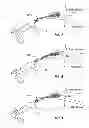 Fig. 07 - Archery bow limb dampening system