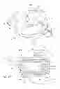 Fig. 16 - Multiple stage blowers and volutes therefor