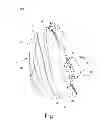 Fig. 02 - REINFORCING MEMBER FOR A PATIENT INTERFACE