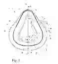 Fig. 08 - REINFORCING MEMBER FOR A PATIENT INTERFACE