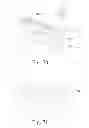 Fig. 35 - REINFORCING MEMBER FOR A PATIENT INTERFACE