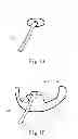 Fig. 02 - Adjustable oral interface and method to maintain upper airway patency