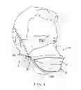 Fig. 02 - REFILL FILTERING FACE-PIECE RESPIRATOR